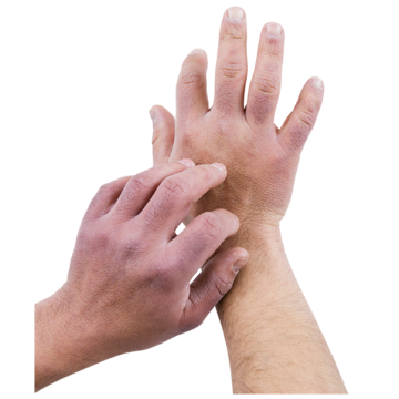 A hand scratching the back of another hand.
