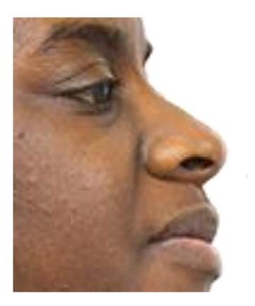A picture of a man's nose