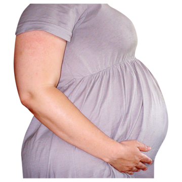 A woman in a dress who has a big tummy because she is pregnant