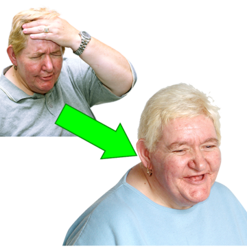 A woman holding her head in pain with a green arrow pointing towards the same woman who is now smiling