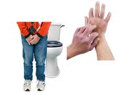A person with their hands in front of their crotch with a toilet behind them and someone scratching their hands.