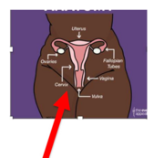 Diagram of female reproductive organs with an arrow pointing to the cervix