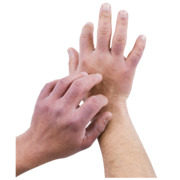 A pair of hands - one is scratching the back of the others arms.