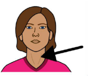A drawing of a woman with an arrow pointing at her neck