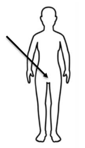 A drawing of an outline of a person with an arrow pointing to their lower private parts