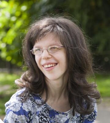 The head and shoulders of a lady with Williams syndrome.