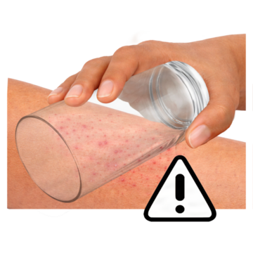 A glass being pressed onto somebody's arm over a rash