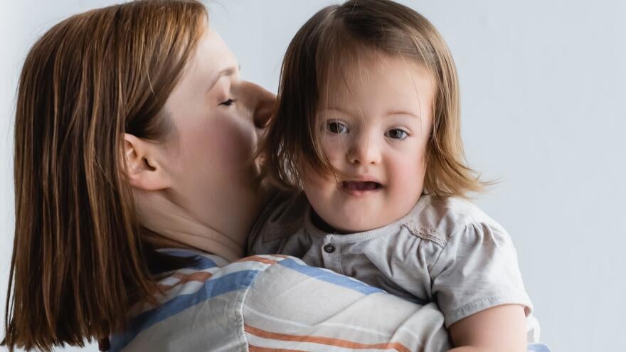 A mother holding and kissing her child with down's syndrome