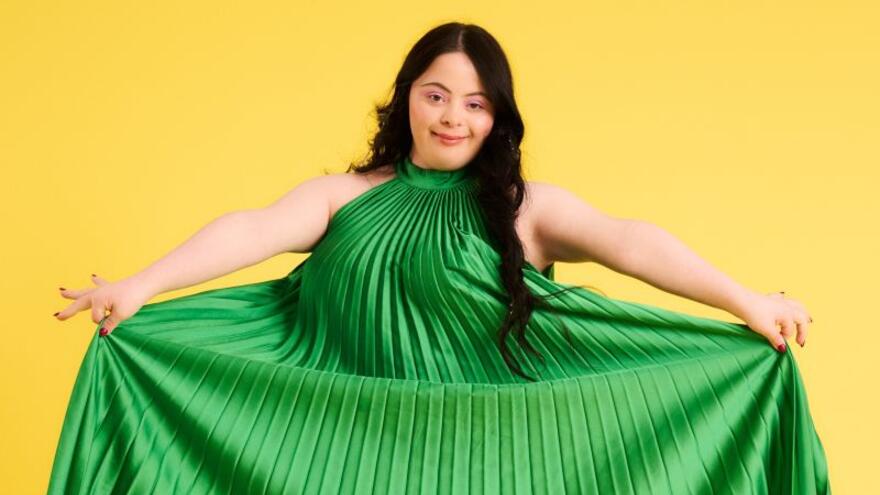 Ellie Goldstein modelling a green dress